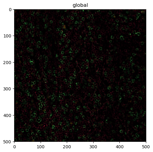 ../_images/notebooks_ExampleWorkflowSpatialdata_13_0.png